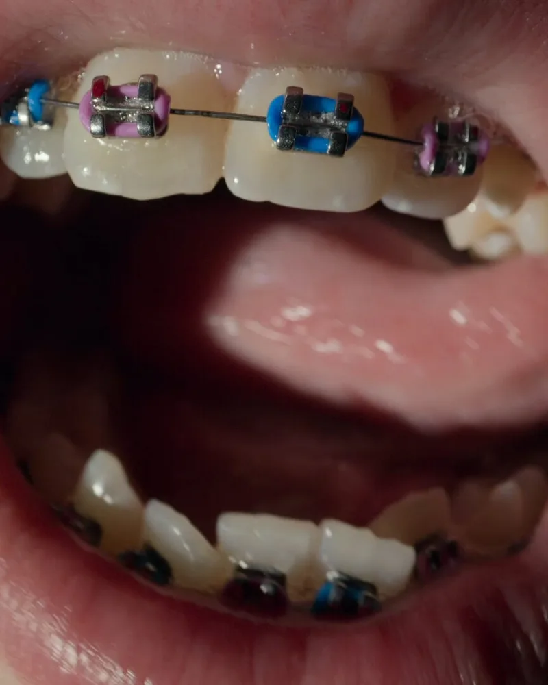 Open Wide Key Image 8x10